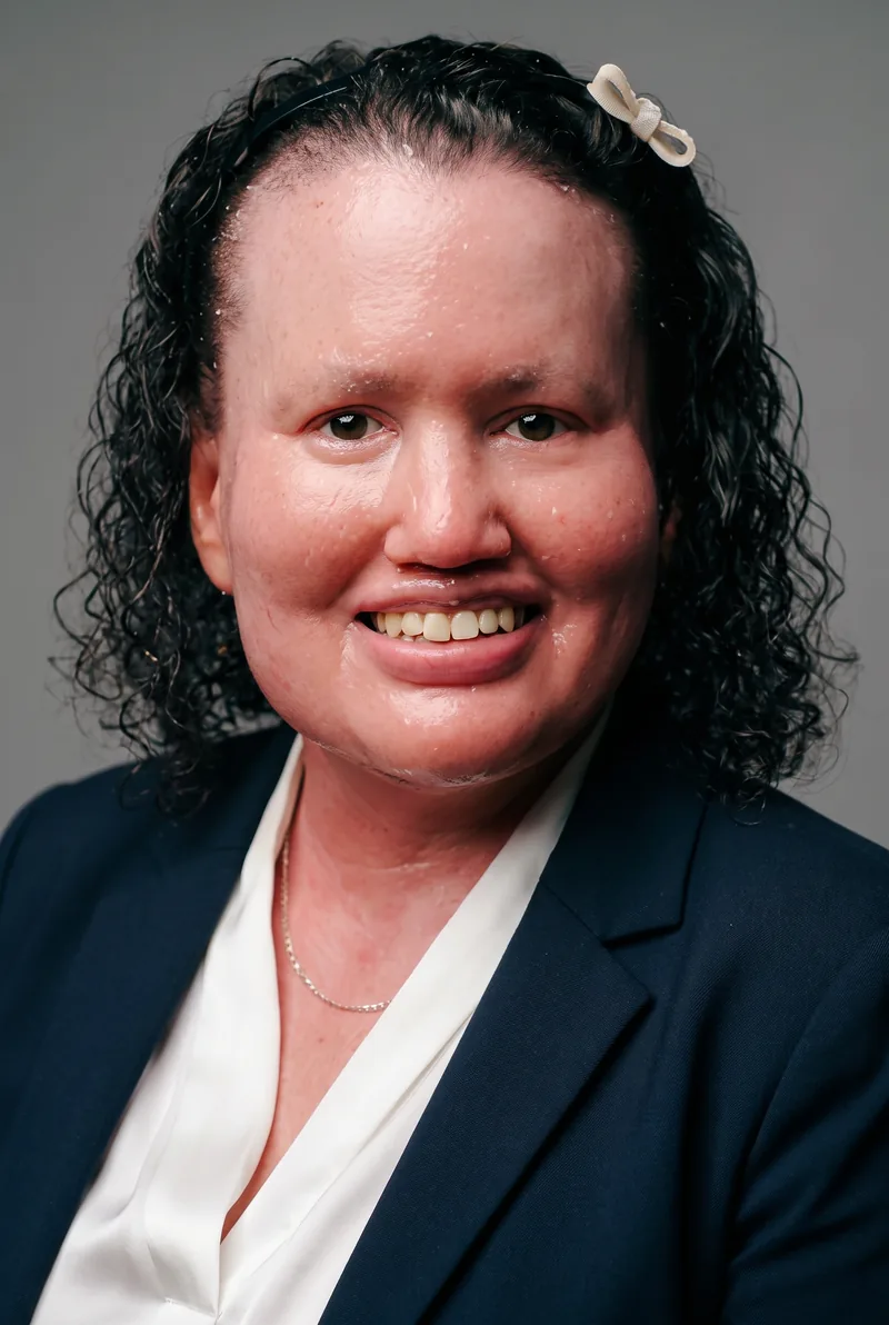 AI-generated portrait of Carly Findlay OAM, keynote speaker